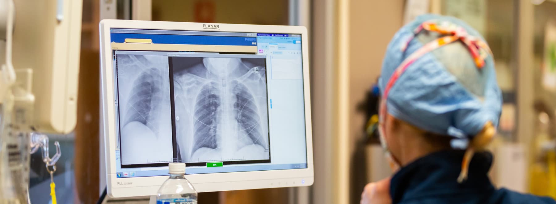 A pulmonologist reviews chest imaging. A pulmonologist reviews chest imaging.